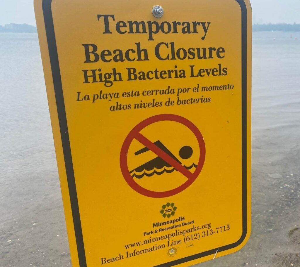 Beach closed